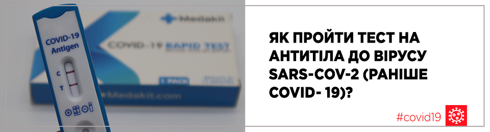 Як пройти тест на антитіла до вірусу SARS-CoV-2 (раніше COVID-19)?