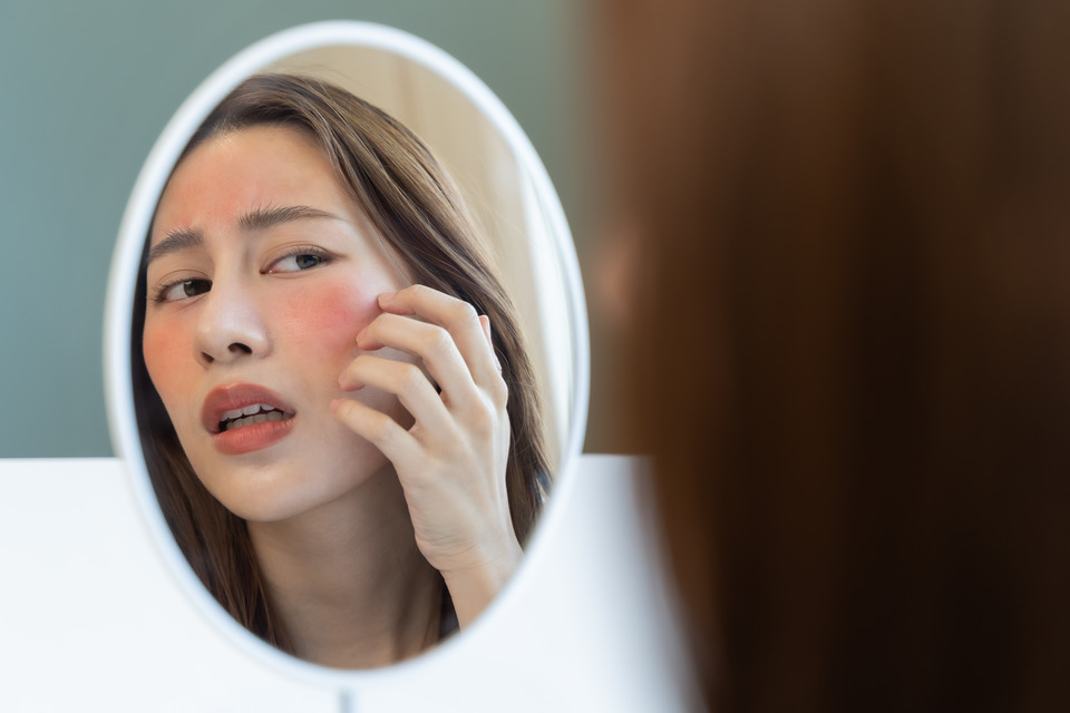 Атопічний дерматит на обличчі