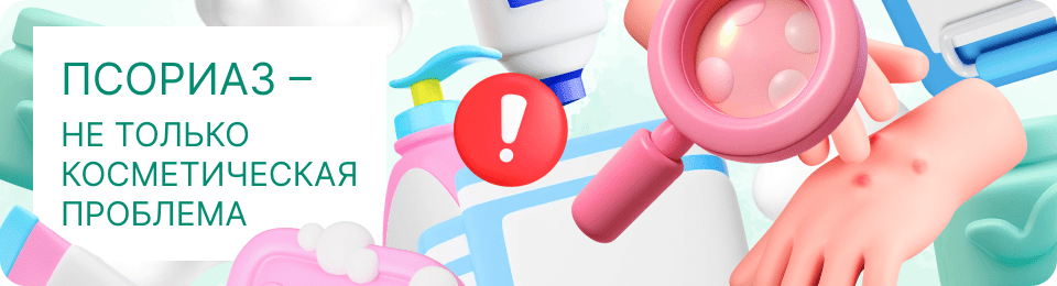 Псориаз – не только косметическая проблема