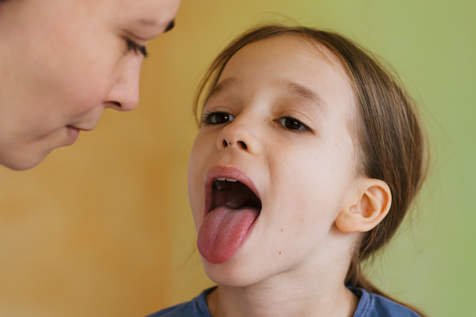 Стоматит у ребенка