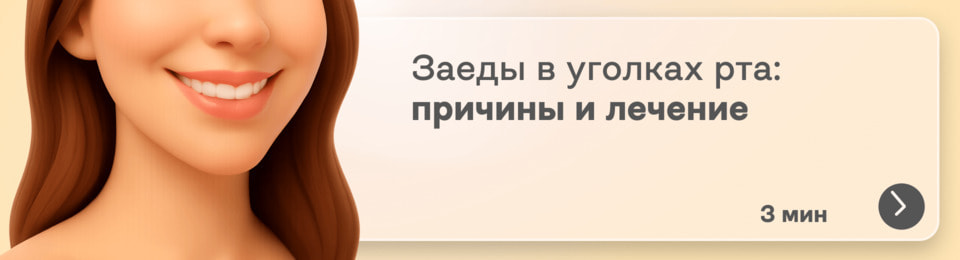 Заеды в уголках рта: от чего появляются и как их вылечить?