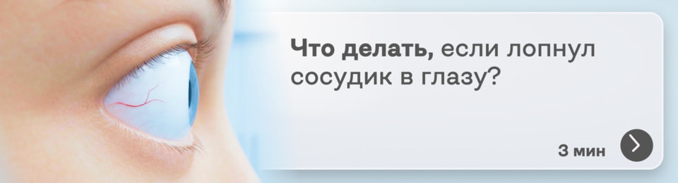 Лопнул сосуд в глазу: когда это просто от усталости, а когда — тревожный симптом
