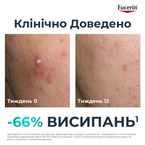 Сироватка для обличчя EUCERIN (Юцерин) DermoPure (ДермоПьюр) для проблемної шкіри потрійної дії 40 мл