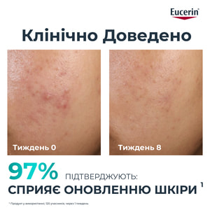 Пилинг для лица EUCERIN (Юцерин) Dermopure (ДермоПьюр) ночной для проблемной кожи 40 мл