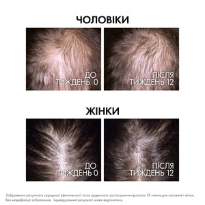 Бустер-сыворотка для волос VICHY (Виши) Деркос Аминексил Клиникал Риджен для восстановления густоты и борьбы с выпадением волос 90 мл