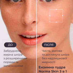 Пудра энзимная MEDDIS (Меддис) Norma Skin Program очищающая 3 в 1 80 г