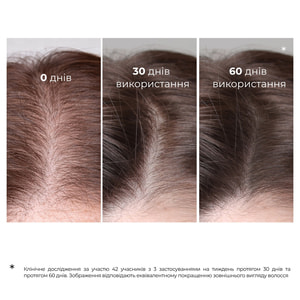 Сыворотка против выпадения волос Elfa Pharm (Эльфа Фарм) Репейная средство №1 с активатором роста Bh Intensive+ 100 мл