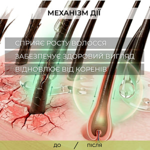 Олія для волосся ELFA PHARM (Ельфа Фарм) 7 олій 7 в 1 проти випадіння волосся 100 мл