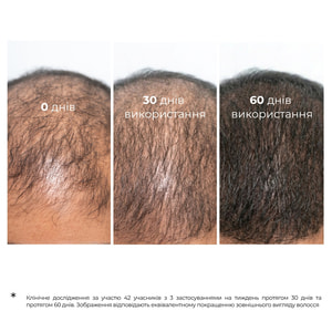 Засіб №1 проти випадіння волосся Elfa Pharm (Ельфа Фарм) з справжньою реп'яховою олією і активатором росту Bh Intensive+ 100 мл