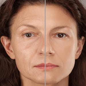 Сыворотка для лица BoLC A+ косметическая против морщин в тубах с дозатором по 5 мл 5 шт